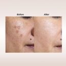 Dalfour Beauty Vitamin C Serum + Chromabright - Most Advanced Skin Brighteners with Intensive Skin Repair