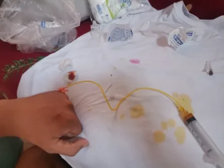 Glutax 2000000GX DualNA Premium Recombined Cell 10 Sessions Glutathione photo review