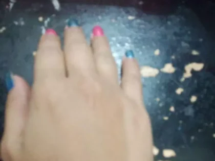 Aqua Skin Veniscy 8 Dual NA Octa Strength Whitening Injection photo review