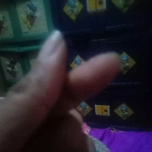 Aqua Skin Veniscy 8 Dual NA Octa Strength Whitening Injection photo review