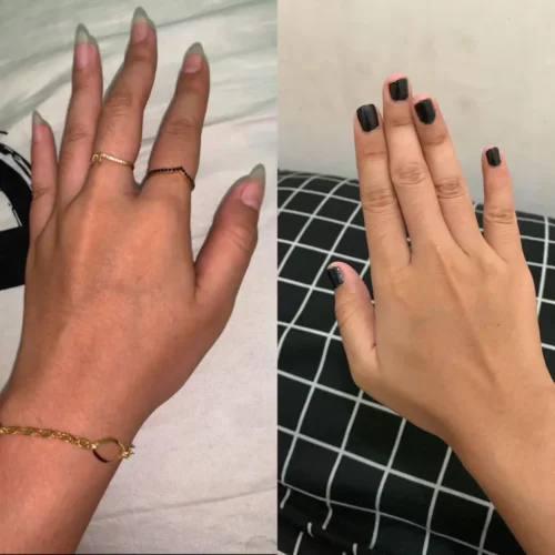 Aqua Skin Veniscy 22 DualNa Pico Cell Ultra Whitening photo review