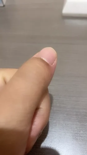 Aqua Skin Veniscy 8 Dual NA Octa Strength Whitening Injection photo review