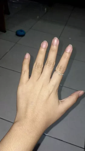 Cindella 1200mg 10 Sessions Gluathione Injection For Skin Whitening photo review