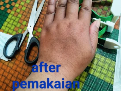 Cindella Glutathione Injections 600 mg full set photo review