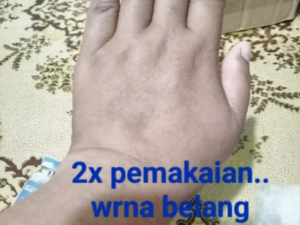 Cindella Glutathione Injections 600 mg full set photo review