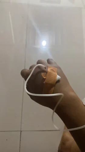 Miracle White 60000mg Glutathione Injection ONE SESSION photo review